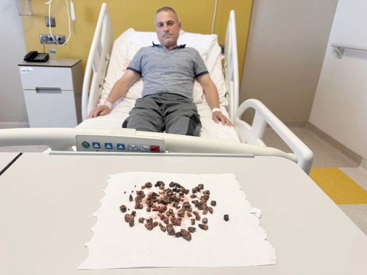 Hastanın böbreğinden 100’e yakın taş çıkarıldı
